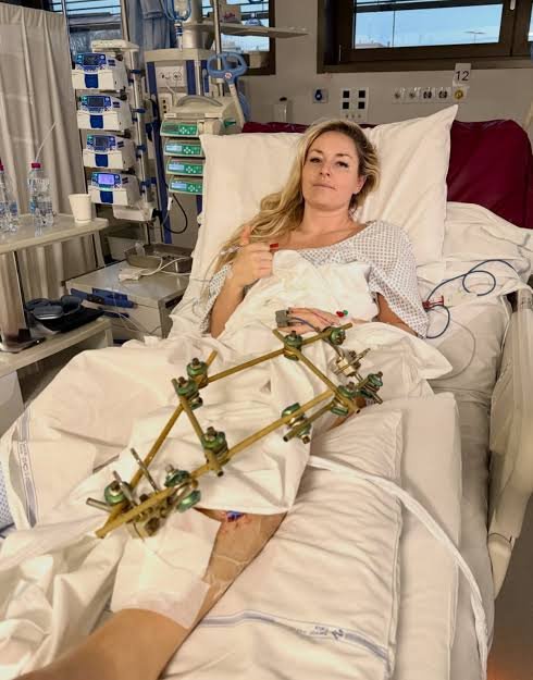 Long, Painful Road to Quickly Recovery: Lindsey Vonn Begins New Battle After Brutal Olympic Injury